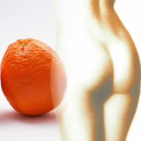 Anti-cellulite treatments Bucharest